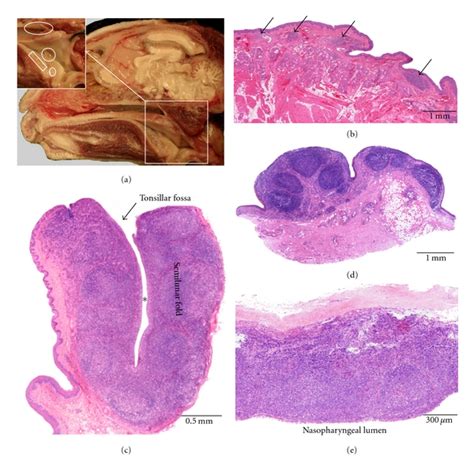 Pharyngeal Tonsils Histology Labeled