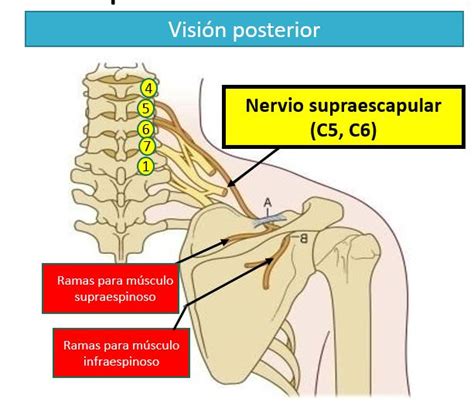 Radiofrecuencia Del Nervio Supraescapular Dolopedia