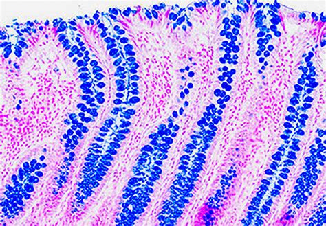 Alcian Blue Ph Goblet Cell Histology Slides