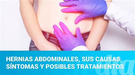 Hernias abdominales sus causas síntomas y posibles tratamientos YouTube