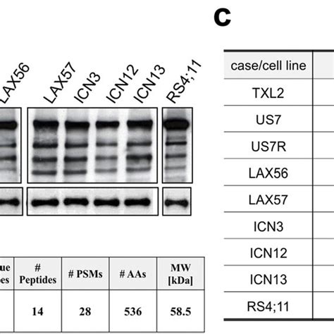 Cca Lectin Chromatography Identifies A Kda Protein In Pre B All