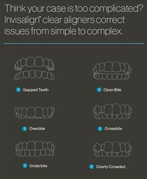 How To Fix Teeth Gap After Braces | mayjustingati