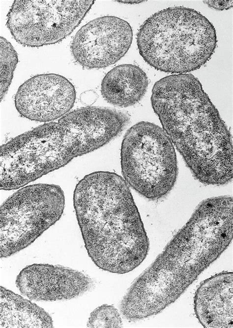 Tem Of E Coli Bacteria By Science Photo Library