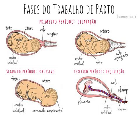 Pr Dromos Trabalho De Parto Braincp