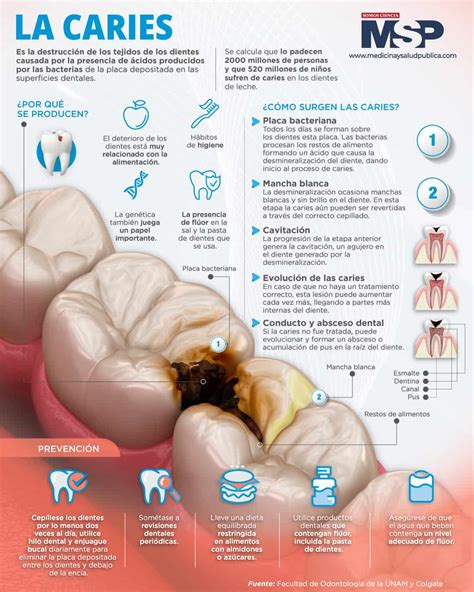 Las Caries Infograf As