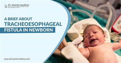 A Brief About Tracheoesophageal Fistula In Newborn Dr Manish Madhav