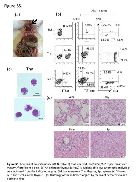 New Mouse Model Of Acute Adult T Cell Leukemia Generated By