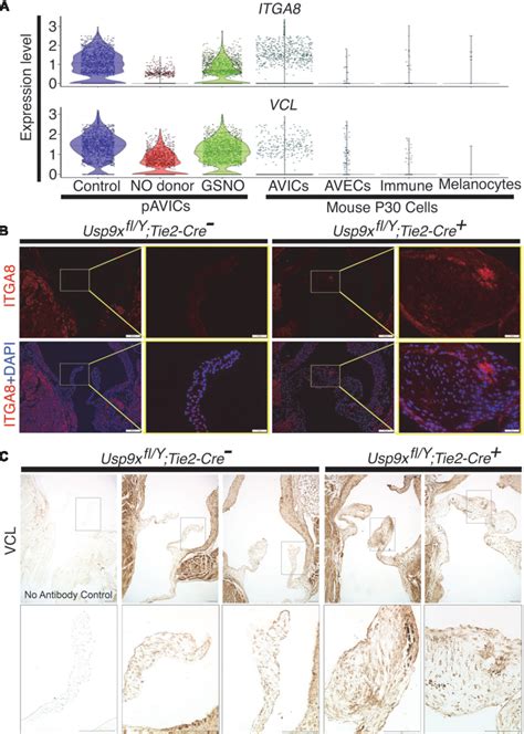 Figure From Single Cell Rna Sequencing Analysis Of Aortic Valve