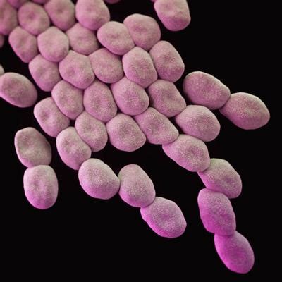 Francisella spp. - Phylogeny, Genomics, Transmission, Pathogenesis ...