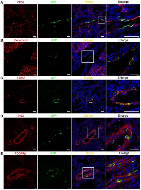 Fstl Was Expressed In Endothelial Cells Vascular Smooth Muscle Cells