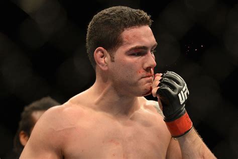 Chris Weidman Injured Pulled From Ufc Title Fight Against Vitor