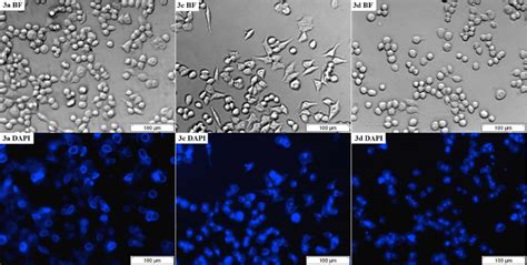 Live Cell Imaging Of The Hct Cells Following Treatment With A C