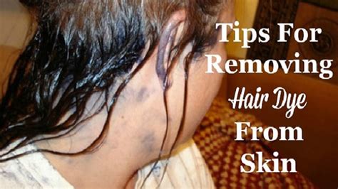 How To Remove Hair Dye Stains On Skin 6 Tips To Get Hair Dye Off Skin