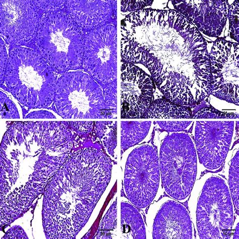 Representative Picture Of Testicular Histology Stained With Hematoxylin