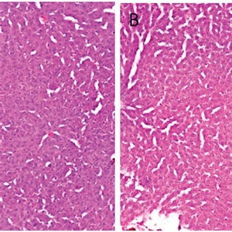 Histological Sections Of Rat Livers Treated In The Subacute