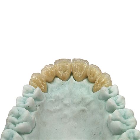 China Puente De Zirconio Cadcam Realizados En Laboratorio Dental