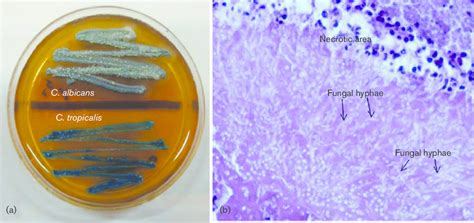 A Colonies Of C Albicans And C Tropicalis On Chromagar Candida B