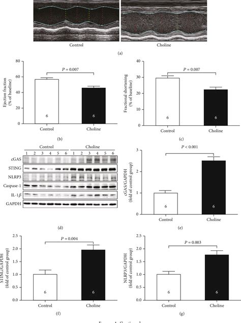 Figure From Hydrogen Sulfide Ameliorated High Choline Induced Cardiac