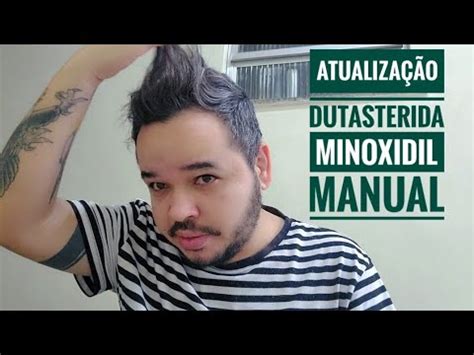 Atualização do tratamento da Manual Dutasterida Minoxidil Oral