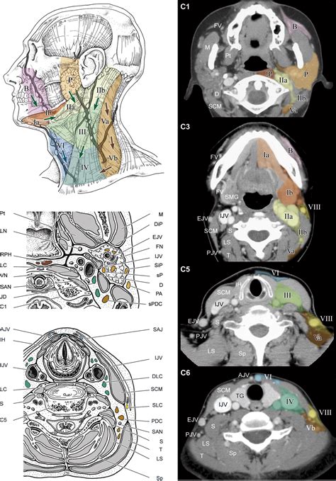 Anatomical Bases For The Radiological Delineation Of Lymph Node Areas