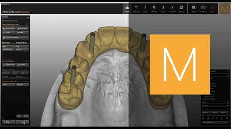 Occlusally Screwed Bridges Module Of Zirkonzahnmodellier Zirkonzahn