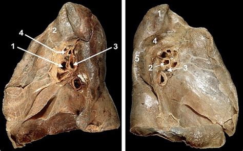 Lung Hilum Diagram Quizlet