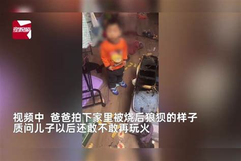 男孩在家玩火引燃家具老爸被烧伤无奈温柔斥责我差点享年34岁