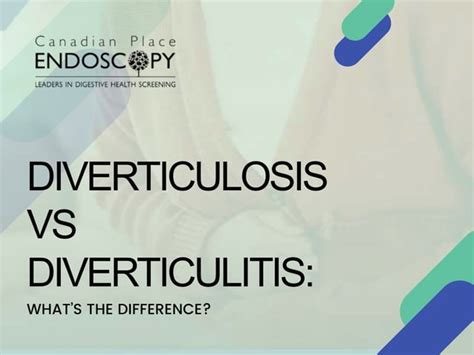 Diverticulosis Vs Diverticulitis Whats The Difference Ppt