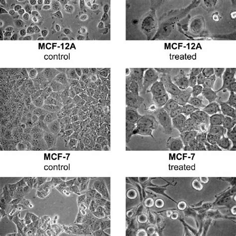 Bright Field Photomicrographs Of MCF 12A MCF 7 And MDA MB 231 Cells