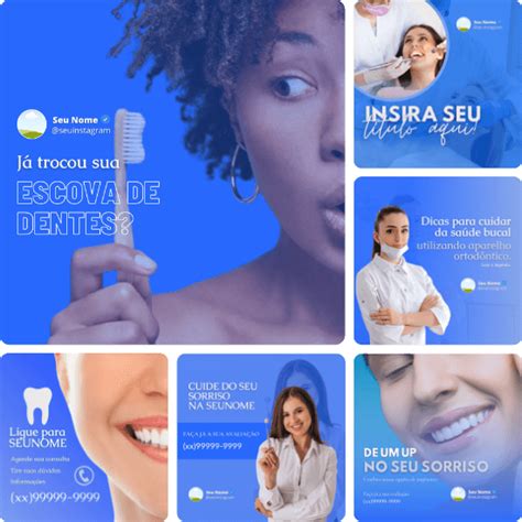 Posts Para Dentistas Pack Canva Artes Edit