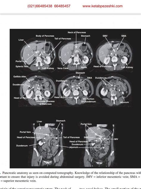 Cross Sectional Anatomy Of The Body Mdct Atlas Artofit