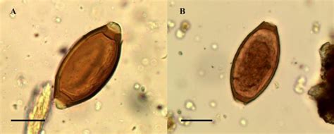 Whipworm Trichuris Sp Eggs From The Settlement At Must Farm A