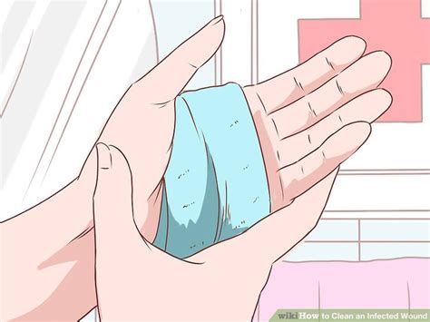 3 Ways to Clean an Infected Wound - wikiHow