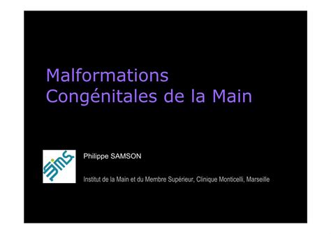 PDF Malformations Cong Nitales De La Main Pouce Flexus Adductus