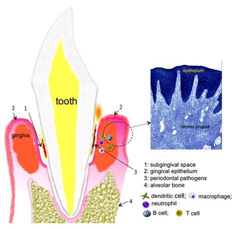 Chematic Representation Of The Periodontal Tissues Supporting The Download Scientific Diagram