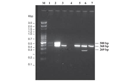 Agarose Gel Electrophoresis Of Pcr Amplified Products Using Multiplex