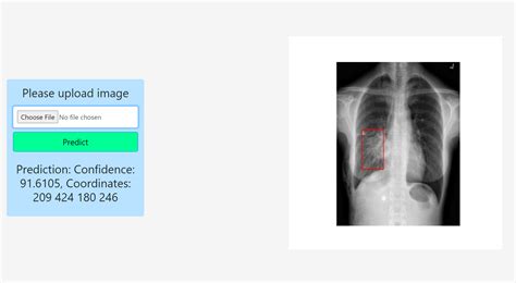 Pneumonia Detection Using Deep Learning Devpost