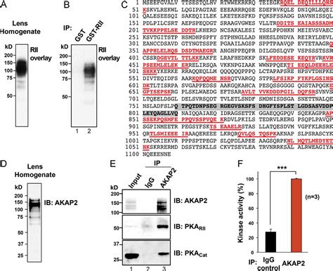 Akap2 Anchors Pka With Aquaporin‐0 To Support Ocular Lens Transparency