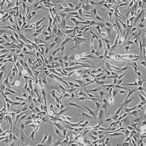 Human Hepatic Stellate Cells - Innoprot Hepatic Cell System