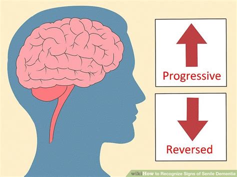 How to Recognize Signs of Senile Dementia (with Pictures)