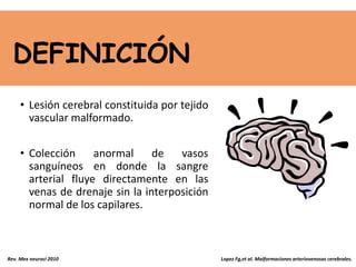 Malformaciones Arteriovenosas Ppt