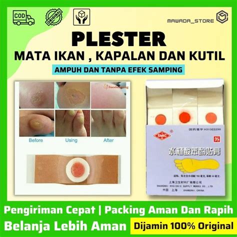 Tanpa Bekas Plester Obat Mata Ikan Plester Obat Kutil Plaster Obat