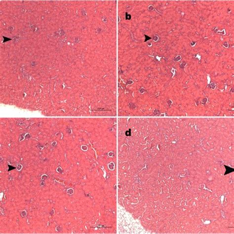 Histopathology of the liver upon administration of Sprague-Dawley rats ...