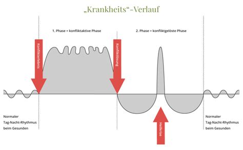 Krankheitsverlauf Nat Rlich Heilen