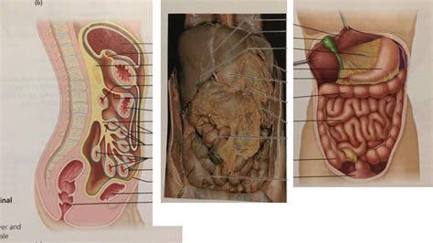 Figure Peritoneal Attachments Of The Abdominal Organs Diagram