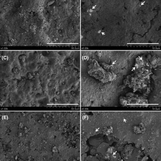 Field Emission Gun Scanning Electron Microscopy Fegsem Secondary