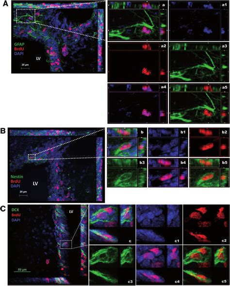 Identification Of BrdU Labeled Proliferating Cells In SVZ After