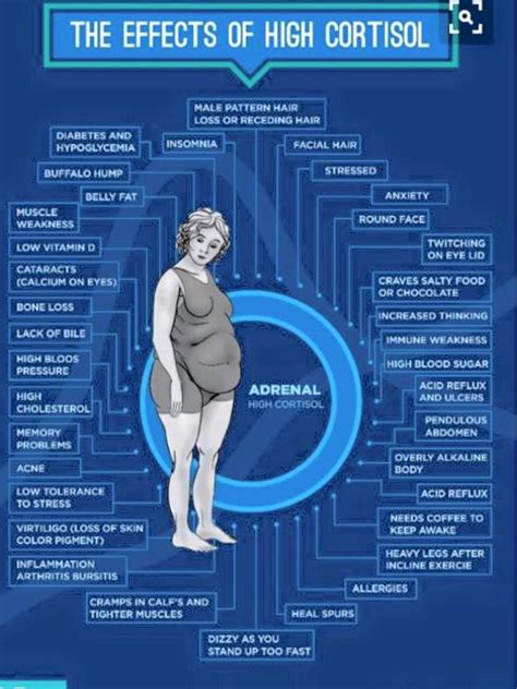 Cushing’s syndrome symptoms – Artofit