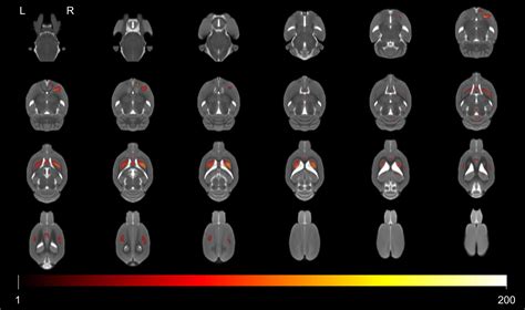 Frontiers Evolution Of Brain Morphology In Spontaneously Hypertensive