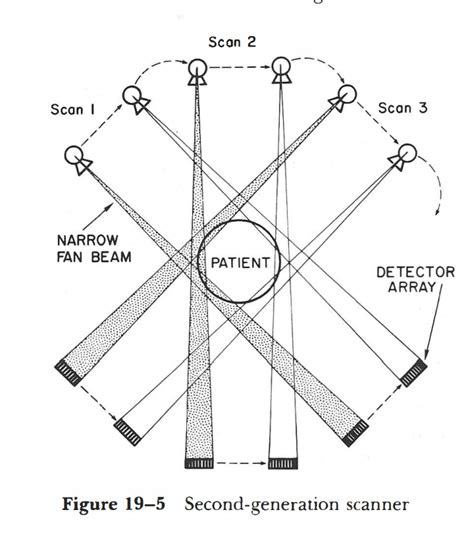 Second Generation Of CT Scan. - radiologystar